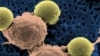 World’s Costliest Medicine Is Gene Treatment Priced at $2 Million